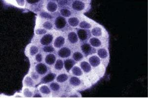 Immunofluorescence staining of PC12 cells. (Tyrosine Hydroxylase 抗体  (AA 18-133))