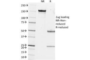 SDS-PAGE Analysis of Purified, BSA-Free Estrogen Inducible Protein pS2 Antibody (clone GE2). (TFF1 抗体  (C-Term))