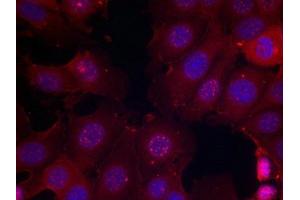 Immunofluorescence (IF) image for anti-Estrogen Receptor 1 (ESR1) (pSer167) antibody (ABIN7138448)
