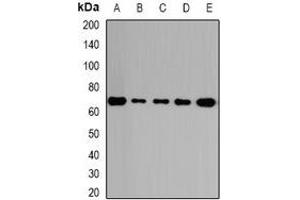 Western blot analysis of GalNAc-T2 expression in HepG2 (A), A431 (B), mouse lung (C), rat kidney (D), rat brain (E) whole cell lysates. (GalNAc-T2 抗体)
