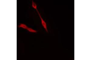ABIN6274372 staining Hela cells by IF/ICC. (TRIP4 抗体  (N-Term))