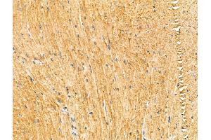 ABIN7094321 and ABIN7098368 at 1/100 staining Mouse heart tissue by IHC-P. (KIF19 抗体  (Internal Region))