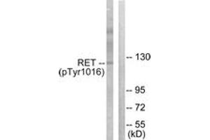 Western blot analysis of extracts from COS7 cells treated with EGF 200ng/ml 30', using Ret (Phospho-Tyr1015) Antibody. (Ret Proto-Oncogene 抗体  (pTyr1015))