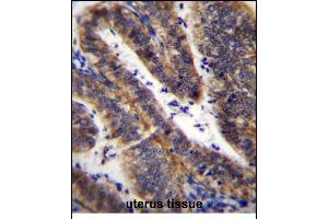 LRRN4CL Antibody (Center) (ABIN656629 and ABIN2845875) immunohistochemistry analysis in formalin fixed and paraffin embedded human uterus tissue followed by peroxidase conjugation of the secondary antibody and DAB staining. (LRRN4CL 抗体  (AA 117-146))