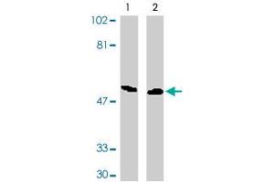 Western blot analysis of DAPK3 expression in HeLa (lane 1) and Jurkat (lane 2) whole cell lysates probed with DAPK3 polyclonal antibody . (DAPK3 抗体  (AA 279-298))