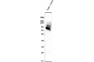 Western blot analysis of AFM using anti-AFM antibody (ABIN7601674).