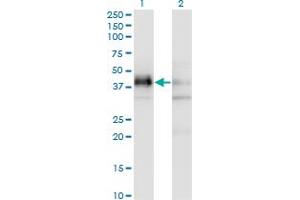 Western Blot analysis of SFRS5 expression in transfected 293T cell line by SFRS5 monoclonal antibody (M03A), clone 2C8. (SRSF5 抗体  (AA 1-272))