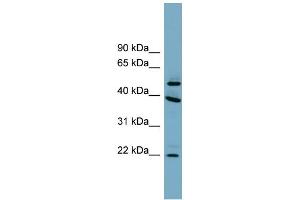 WB Suggested Anti-C4orf20 Antibody Titration: 0.