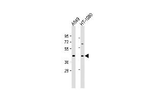 All lanes : Anti-DUX4 Antibody (C-term) at 1:2000 dilution Lane 1: A549 whole cell lysate Lane 2: HT-1080 whole cell lysate Lysates/proteins at 20 μg per lane. (DUX4 抗体  (C-Term))