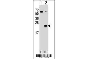 Western blot analysis of DUSP3 using rabbit polyclonal DUSP3 Antibody (C171) using 293 cell lysates (2 ug/lane) either nontransfected (Lane 1) or transiently transfected (Lane 2) with the DUSP3 gene. (Dual Specificity Phosphatase 3 (DUSP3) (AA 157-185), (C-Term) 抗体)