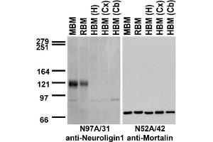 Immunoblot against crude membranes from whole mouse (MBM) or rat (RBM) brain and from human hippocampus [HBM(H)], cerebral cortex [HBM(Cx)] or cerebellum [HBM(Cb)] probed with N97A/31 (left) or N52A/42 (right) TC supe. (Neuroligin 1 抗体  (C-Term, Intracellular))