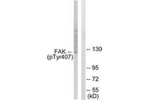 Western blot analysis of extracts from COS7 cells treated with EGF 200ng/ml 30', using FAK (Phospho-Tyr407) Antibody. (FAK 抗体  (pTyr407))