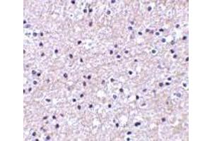 Immunohistochemistry of IEX-1 in human liver tissue with IEX-1 antibody at 2. (IER3 抗体  (Center))