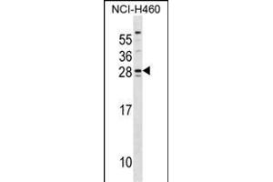 SH3BGR Antibody (Center) (ABIN1537875 and ABIN2848568) western blot analysis in NCI- cell line lysates (35 μg/lane). (SH3BGR 抗体  (AA 149-177))