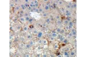 Immunohistochemistry (IHC) image for anti-Killer Cell Immunoglobulin-Like Receptor, Two Domains, Long Cytoplasmic Tail, 5A (KIR2DL5A) (AA 22-375) antibody (ABIN5013836)