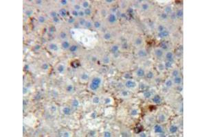 Used in DAB staining on fromalin fixed paraffin-embedded liver tissue (KIR2DL5A 抗体  (AA 22-375))