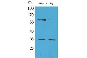 Western Blotting (WB) image for anti-Fc gamma RII (CD32) (C-Term) antibody (ABIN3178160) (Fc gamma RII (CD32) (C-Term) 抗体)