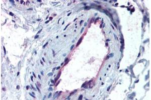 Anti-ACVR1 antibody IHC staining of human skeletal muscle, vessel.