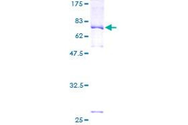 PREB Protein (AA 1-417) (GST tag)