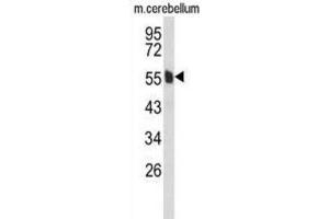 Western Blotting (WB) image for anti-Membrane Protein, Palmitoylated 6 (MAGUK P55 Subfamily Member 6) (MPP6) antibody (ABIN3004081) (MPP6 抗体)
