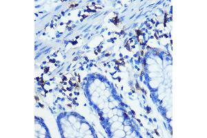 Immunohistochemistry of paraffin-embedded human colon using CD3H Rabbit mAb (ABIN7266174) at dilution of 1:100 (40x lens). (CD247 抗体)