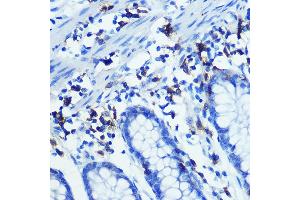 Immunohistochemistry of paraffin-embedded human colon using CD3H Rabbit mAb (ABIN7266174) at dilution of 1:100 (40x lens).