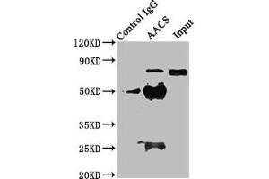 Immunoprecipitating AACS in HEK293 whole cell lysate Lane 1: Rabbit control IgG instead of ABIN7142936 in HEK293 whole cell lysate. (AACS 抗体  (AA 435-598))