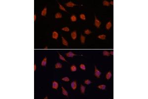 Immunofluorescence analysis of L929 cells using KCN antibody (ABIN7269481) at dilution of 1:100.