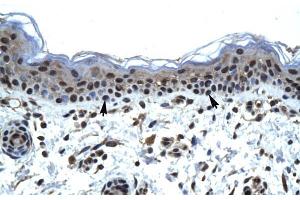 Human Skin; ZNFN1A5 antibody - N-terminal region in Human Skin cells using Immunohistochemistry (IKZF5 抗体  (N-Term))