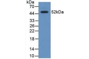 Detection of Recombinant SAP, Human using Polyclonal Antibody to Serum Amyloid P Component (SAP) (APCS 抗体  (AA 23-223))