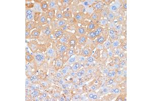 Immunohistochemistry of paraffin-embedded mouse liver using APCS antibody (ABIN3022713, ABIN3022714, ABIN3022715, ABIN1512583 and ABIN6219158) at dilution of 1:100 (40x lens). (APCS 抗体  (AA 1-223))