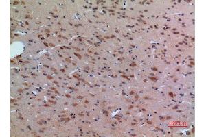 Immunohistochemistry (IHC) image for anti-Arginine (ARG) (Internal Region) antibody (ABIN3187869)
