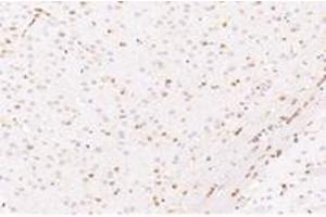 Immunohistochemistry analysis of paraffin-embedded mouse striatum using,CYPIVF11 (ABIN7073679) at dilution of 1: 12000 (CYP4F11 抗体)