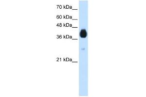 WB Suggested Anti-DLX5 Antibody Titration:  1. (DLX5 抗体  (N-Term))