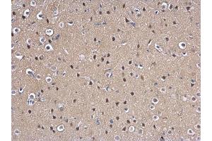 Immunohistochemistry (IHC) image for anti-MAD2 Mitotic Arrest Deficient-Like 1 (Yeast) (MAD2L1) (C-Term) antibody (ABIN2855897)