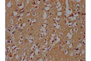 IHC image of ABIN7139719 diluted at 1:100 and staining in paraffin-embedded human brain tissue performed on a Leica BondTM system. (SNCA 抗体  (AA 119-136))