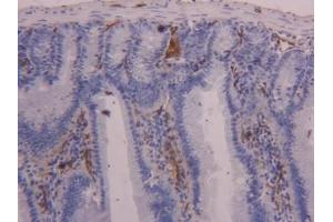 Immunohistochemistry (IHC) image for anti-Fatty Acid Binding Protein 4, Adipocyte (FABP4) (AA 2-132) antibody (ABIN7436912)
