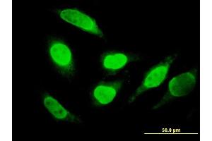 Immunofluorescence of monoclonal antibody to RUNDC2A on HeLa cell. (SNX29 抗体  (AA 1-249))