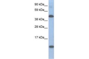 Western Blotting (WB) image for anti-Ligand Dependent Nuclear Receptor Corepressor (Lcor) antibody (ABIN2461545) (Lcor 抗体)