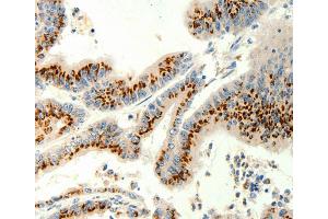 Immunohistochemistry (IHC) image for anti-Transient Receptor Potential Cation Channel, Subfamily C, Member 6 (TRPC6) antibody (ABIN2426989) (TRPC6 抗体)