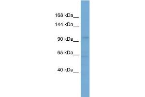 WB Suggested Anti-SLCO5A1 Antibody Titration: 0. (SLCO5A1 抗体  (Middle Region))