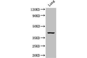 Western Blot Positive WB detected in: Mouse lung tissue All lanes: CYSLTR1 antibody at 3 μg/mL Secondary Goat polyclonal to rabbit IgG at 1/50000 dilution Predicted band size: 39 kDa Observed band size: 39 kDa (CysLTR1 抗体  (AA 298-337))