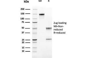 SDS-PAGE Analysis Purified Cathepsin K Mouse Monoclonal Antibody (CTSK/2791). (Cathepsin K 抗体  (AA 163-274))