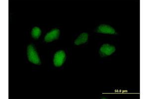 Immunofluorescence of purified MaxPab antibody to RPE on HeLa cell. (RPE 抗体  (AA 1-228))