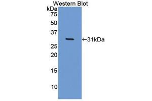 Western blot analysis of the recombinant protein. (Versican 抗体  (AA 2958-3209))