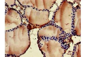 Immunohistochemistry of paraffin-embedded human thyroid tissue using ABIN7153070 at dilution of 1:100 (FOXN1 抗体  (AA 1-160))