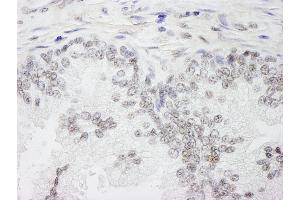 Immunohistochemistry (IHC) image for anti-Wilms Tumor 1 Associated Protein (WTAP) (AA 346-396) antibody (ABIN7449036)