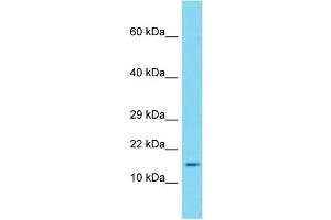 Host:  Rabbit  Target Name:  Saa1  Sample Type:  Mouse Thymus lysates  Antibody Dilution:  2. (SAA1 抗体  (Middle Region))