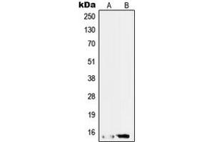 Western blot analysis of SAP14 expression in HepG2 (A), RT4 (B) whole cell lysates. (Pre-mRNA Branch Site Protein p14 (SF3B14) (C-Term) 抗体)