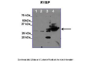 Lanes:   1. (RYBP 抗体  (C-Term))